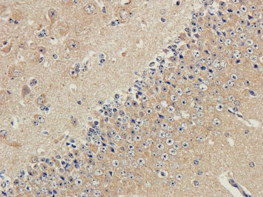 Tyrosine Hydroxylase Rabbit Polyclonal Antibody
