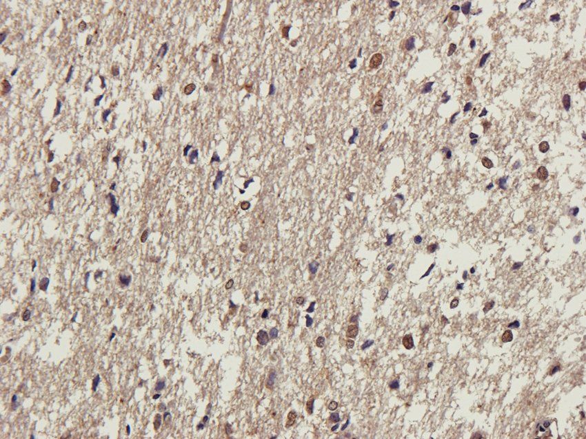 Tyrosine Hydroxylase Rabbit Polyclonal Antibody