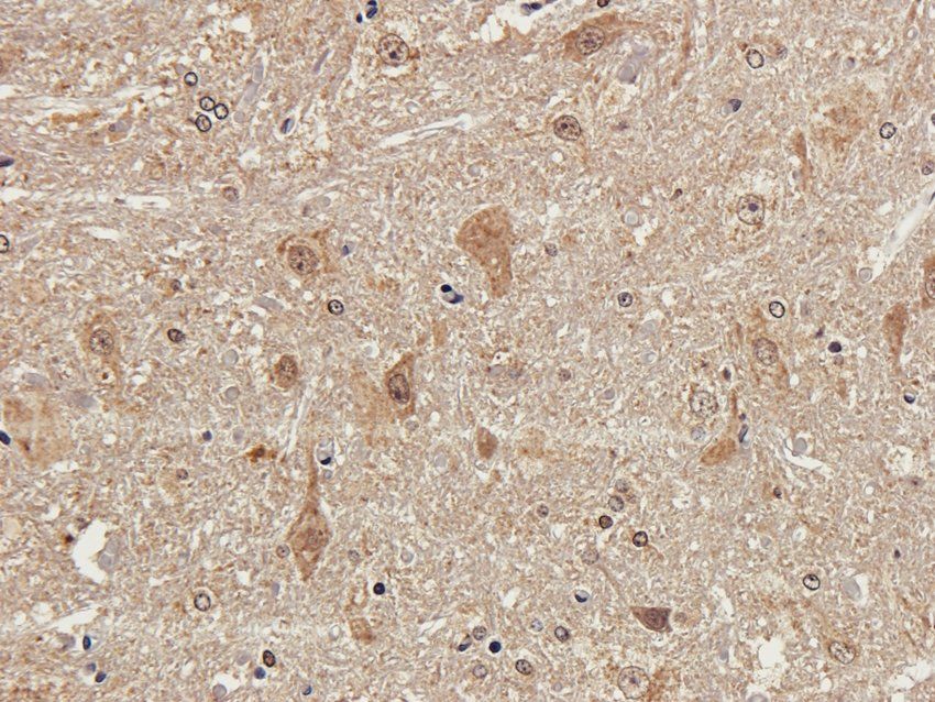 Tyrosine Hydroxylase Rabbit Polyclonal Antibody