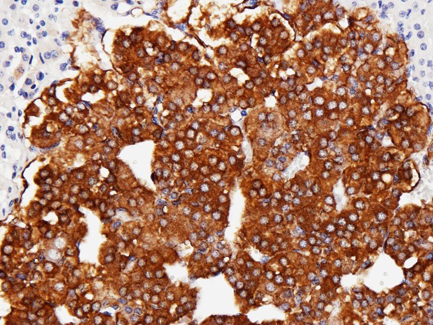 Tyrosine Hydroxylase Rabbit Polyclonal Antibody