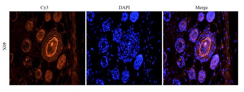 TGF beta 1 Rabbit Polyclonal Antibody