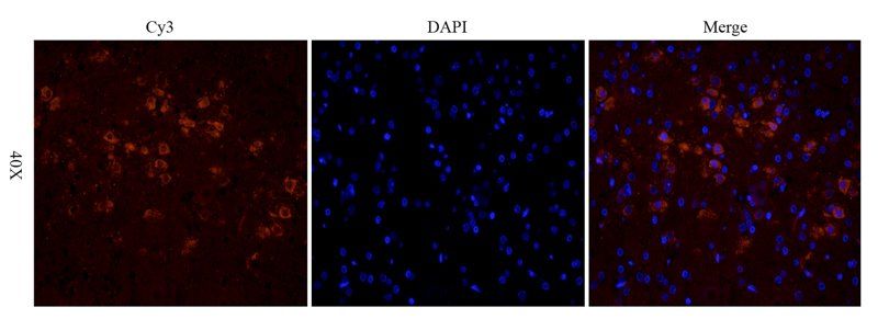 TGF beta 1 Rabbit Polyclonal Antibody