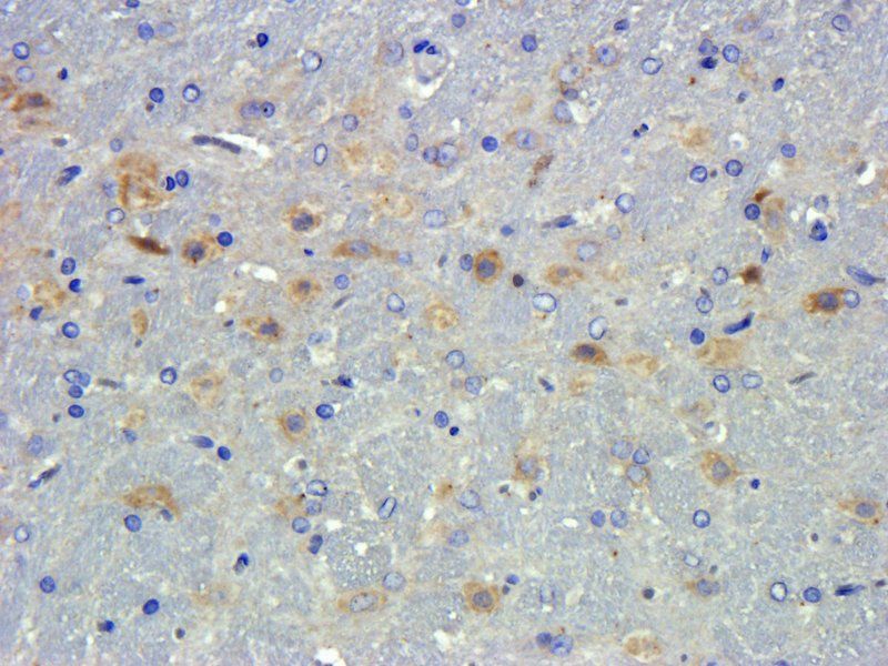 TGF beta 1 Rabbit Polyclonal Antibody