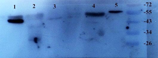 TGF beta 1 Rabbit Polyclonal Antibody