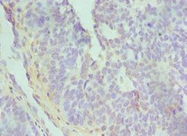 TGFBI Antibody