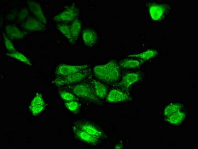 TPH2 Antibody