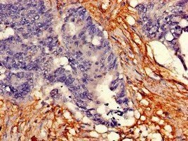 TPH2 Antibody