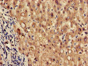 TPH2 Antibody