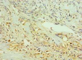 NTRK2 Antibody