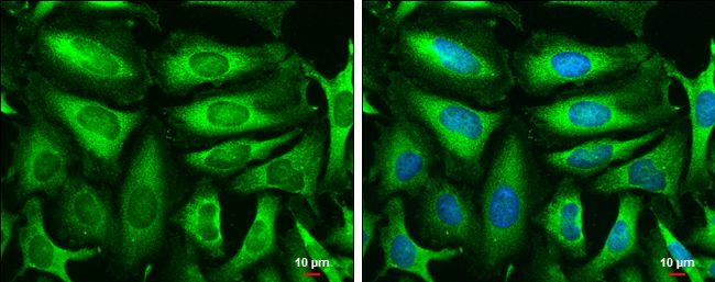 Triosephosphate isomerase Rabbit Polyclonal Antibody
