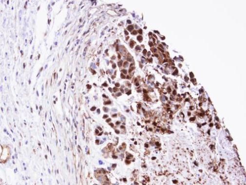 Triosephosphate isomerase Rabbit Polyclonal Antibody