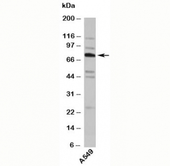 Orb248118-25ug | TNFAIP2 tumor necrosis factor, alpha-induced protein