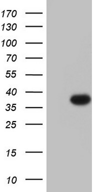 Smad Interacting Protein 1 (ZEB2) antibody