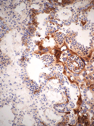 Frozen sections of Murine placenta with inflammation and necrosis