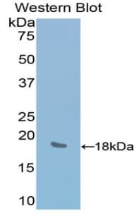 LYAR Antibody (aa270-388, Cy3)