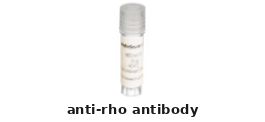 Rabbit Anti-RHO Polyclonal Antibody – Cat# MBS8557190