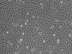 NB-26-00209-500 | Human Retinal Microvascular Pericytes (HRMPVCs)