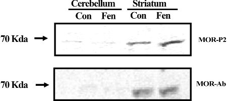 estern blots of isolated mouse brain striatum and cerebellum for the non-phospho-MOR antibody or the MOR-P2 antibody