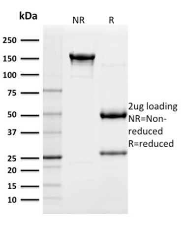 SDS-PAGE Analysis of Purified CD117 Mouse Monoclonal Antibody (KIT/982). Confirmation of Integrity and Purity of Antibody