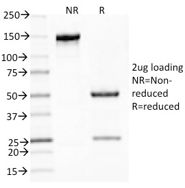 SDS-PAGE Analysis of Purified MUC5AC Mouse Monoclonal Antibody (CLH2). Confirmation of Integrity and Purity of Antibody