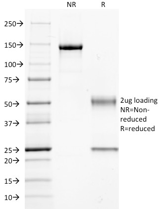 SDS-PAGE Analysis of Purified CD14 Mouse Monoclonal Antibody (LPSR/654). Confirmation of Integrity and Purity of Antibody.