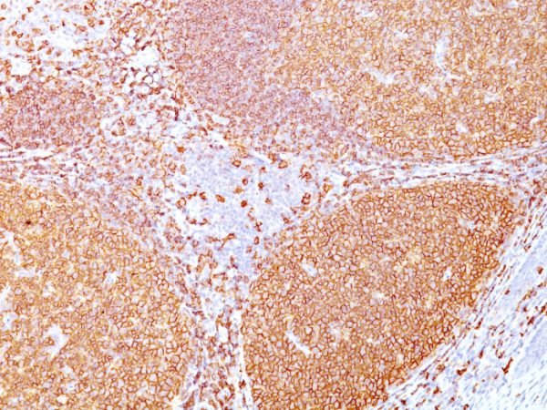 Formalin-fixed, paraffin-embedded human tonsil stained with CD20 Mouse Recombinant Monoclonal Antibody (rIGEL/773).