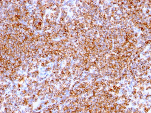 Formalin-fixed, paraffin-embedded human lymph node stained with CD20 Mouse Recombinant Monoclonal Antibody (rIGEL/773).