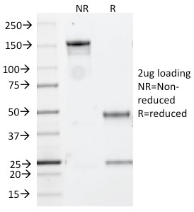 SDS-PAGE Analysis PurifiedCD20 Mouse Recombinant Monoclonal Antibody (rIGEL/773). Confirmation of Purity and Integrity of Antibody.