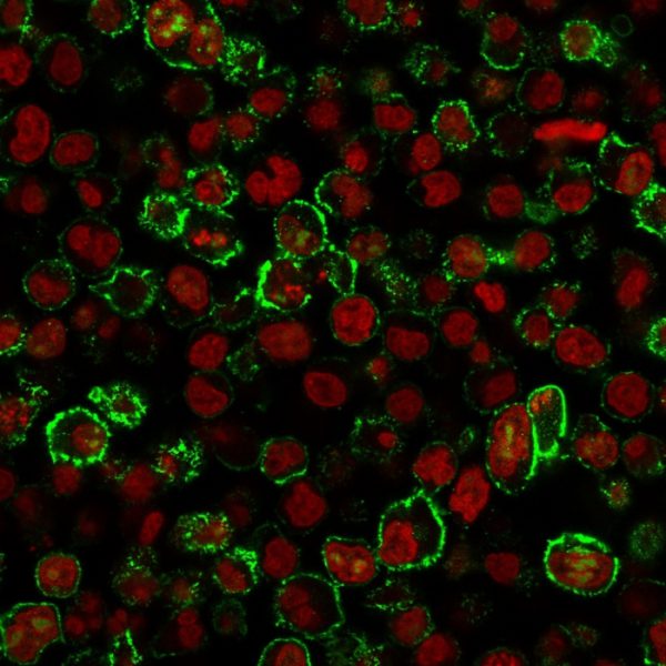 Immunofluorescence staining of Raji cells using CD20 Mouse Recombinant Monoclonal Antibody (rIGEL/773) followed by goat anti-mouse IgG-CF488 (green). Nuclei stained with RedDot.