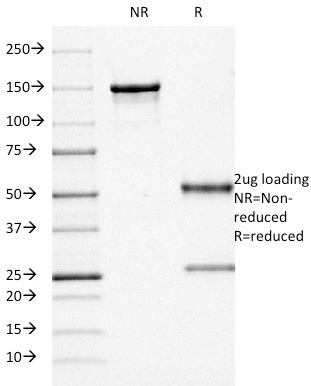 SDS-PAGE Analysis of Purified CD68 Mouse Monoclonal Antibody (KP1). Confirmation of Purity and Integrity of Antibody.