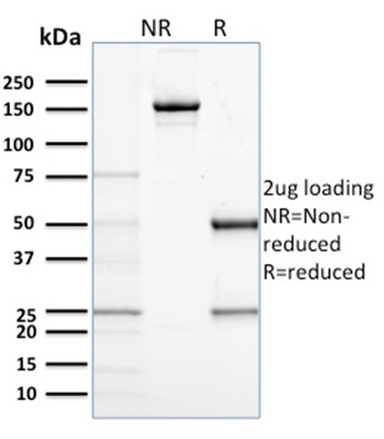 SDS-PAGE Analysis Purified CD68 Mouse Monoclonal Antibody (C68/684).