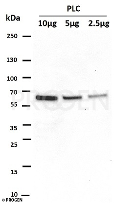 anti-p62/ SQSTM1 (C-terminus) guinea pig polyclonal, serum