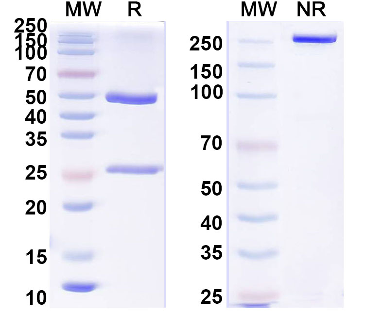 SDS-PAGE for Anti-Human MMP2 Antibody (SAA1441)