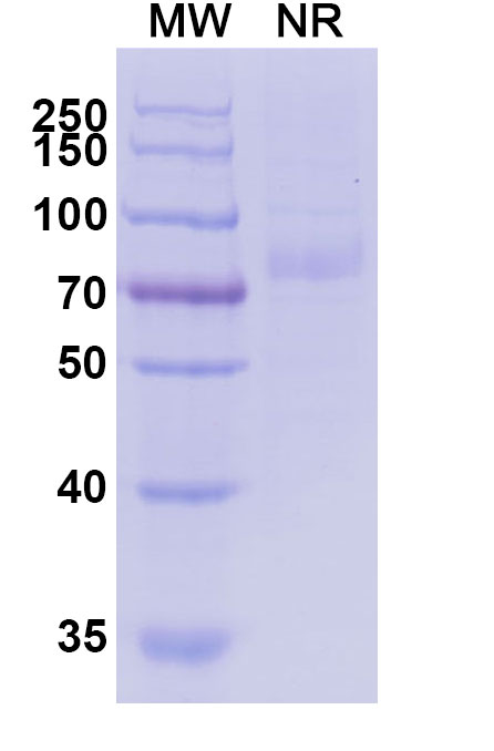 SDS-PAGE for Receptor tyrosine-protein kinase erbB-3(ERBB3)His Tag