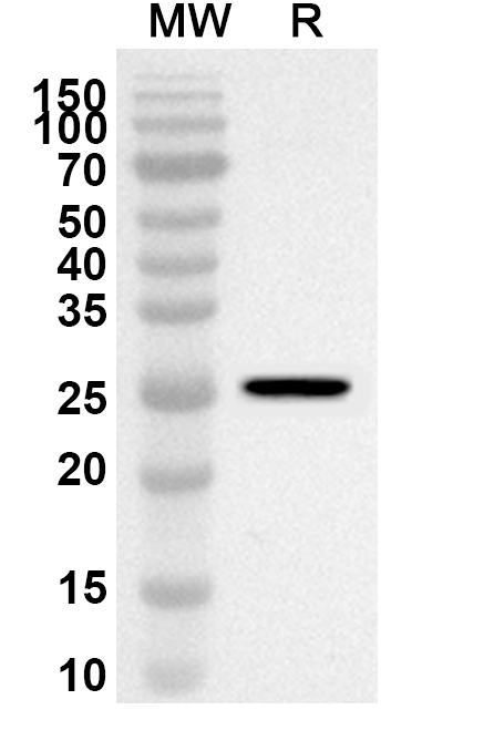 Anti-Bovine Bos d 11/CSN2 Polyclonal Antibody binds to Recombinant Bovine Bos d 11/CSN2 Protein, N-His in WB Assay