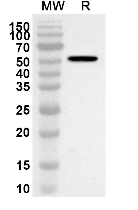Anti-BCCV N/Nucleoprotein Polyclonal Antibody in WB Assay