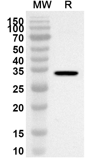 Anti-Human GATA2 Polyclonal Antibody binds to Recombinant Human GATA2, N-His in WB Assay