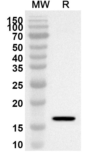 Anti-Human KCNA3 Polyclonal Antibody binds to Recombinant Human KCNA3 Protein, N-His in WB Assay