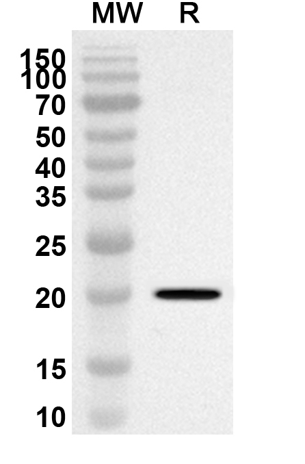 Anti-Human OVOL1 Polyclonal Antibody binds to Recombinant Human OVOL1 Protein, N-His in WB Assay