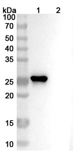Anti-Human ROBO4 Antibody (MAb1) binds to Recombinant Human ROBO4 Protein, N-His in WB Assay