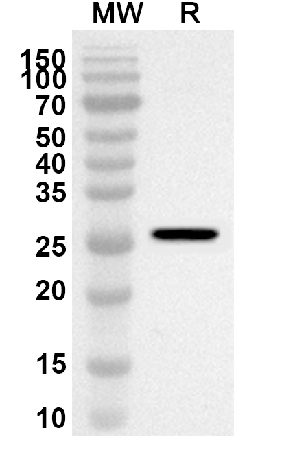 Anti-Human TEAD4 Polyclonal Antibody binds to Recombinant Human TEAD4 Protein, N-His in WB Assay