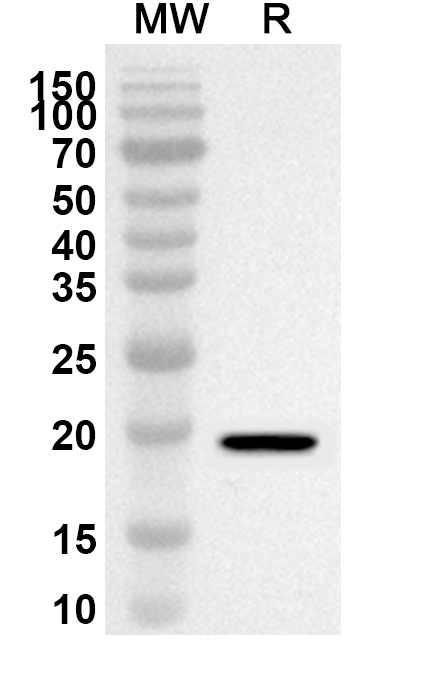 Anti-WNT11 Polyclonal antibody binds to Recombinant Human WNT11, N-His in WB Assay