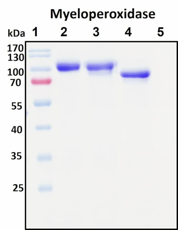 Recombinant Human Myeloperoxidase (MPO) Protein