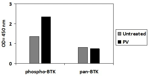 Human Phospho-BTK (Y551) ELISA Kit