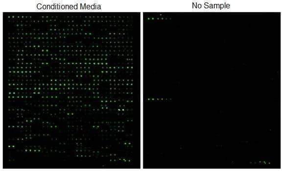 Human Glycosylation Array 1000