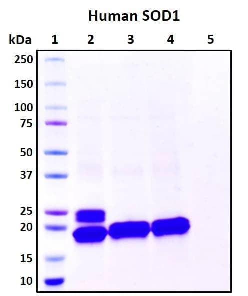 Recombinant Human Superoxide Dismutase 1 (SOD1) Protein