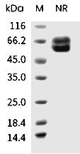 Human respiratory syncytial virus (RSV) Fusion Protein (aa 1-525, His)