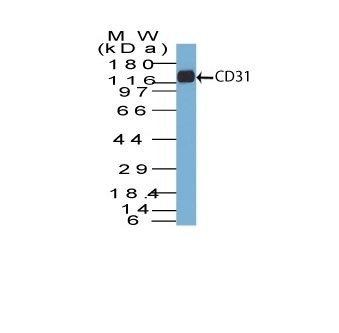 Monoclonal anti CD31 / PECAM 1 (C31.7)