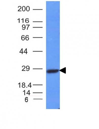Monoclonal anti Kappa Light Chain (L1C1)