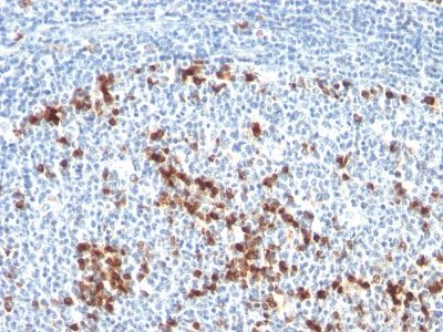 Monoclonal anti Kappa Light Chain (L1C1)